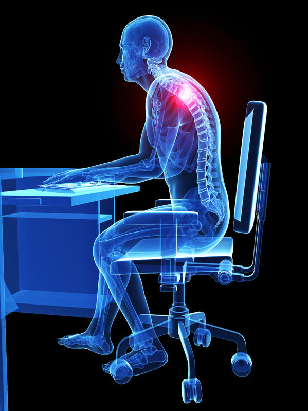 posture pain
